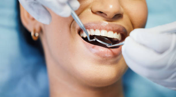 Best Broken or Cracked Tooth Emergency Dentist in Wildomar, CA