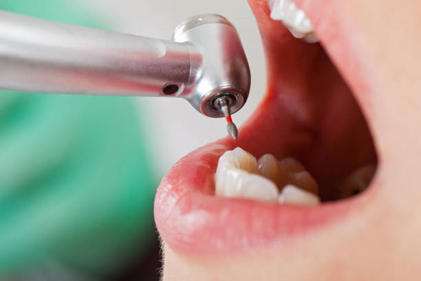 Best Emergency Dental Services for Seniors in Wildomar, CA
